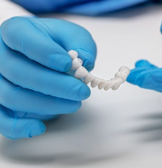 dentist holds ceramic dental crowns in his hands, zirconium bridge, close-up dentist holds ceramic dental crowns in his hands, zirconium bridge, close-up