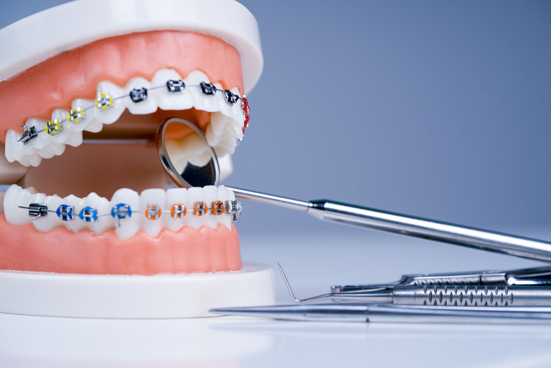 Orthodontics treatment. Orthodontic model and dentist tool - demonstration teeth model of varities of orthodontic bracket or brace. Orthodontics treatment. Orthodontic model and dentist tool - demonstration teeth model of varities of orthodontic bracket or brace.