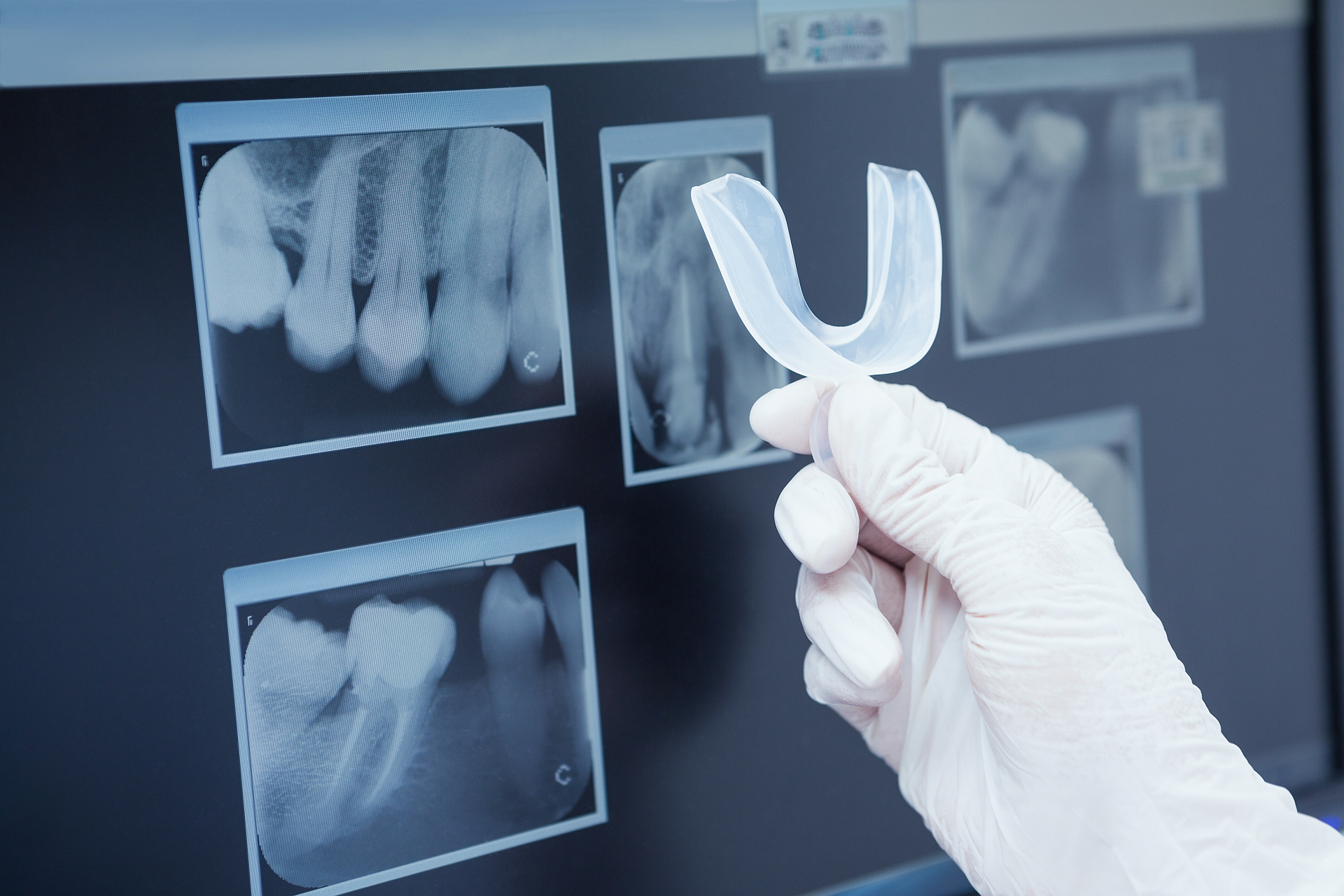 Diagnostyka radiologiczna